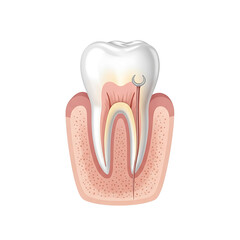 Medical illustration depicting a cross-section of a tooth, showcasing inner structures and root canal procedure