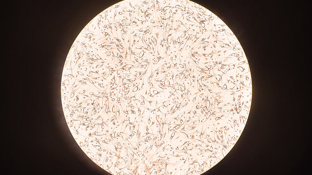 Human glioblastoma cells.