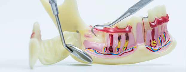Dental Demonstration Using Jaw Anatomy Model