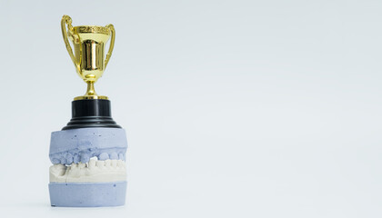 Dental Trophy Displayed on Plaster Cast Model