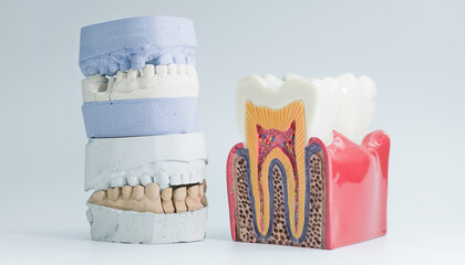 Tooth anatomy model and dental cast comparison