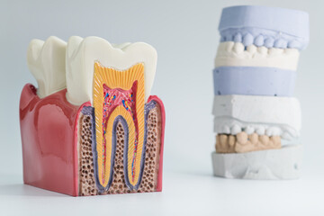 Tooth anatomy model with dental cast background
