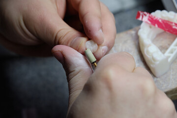 Dental technician carefully polishing a zirconium dioxide crown or veneer.