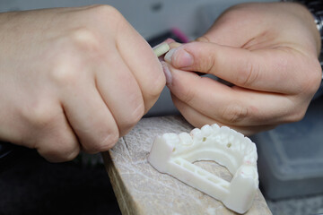 Dental technician carefully polishing a zirconium dioxide crown or veneer.