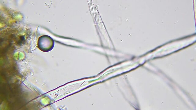 Many unicellular microbes moving rapidly under microscope 400x (brightfield, immersion oil)