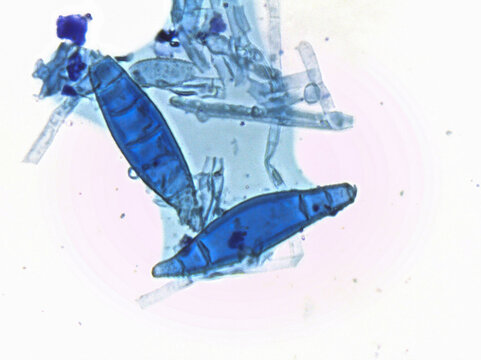 Micrograph showing large, canoe-shaped, blue-stained macroconidia of a dermatophyte fungus