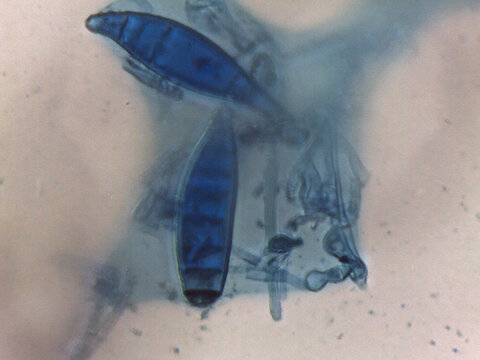 Micrograph showing large, canoe-shaped, blue-stained macroconidia of a dermatophyte fungus