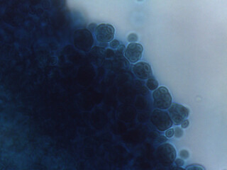 Sexual or survival structure: A spherical ascocarp or sporangium connected to fine hyphae.