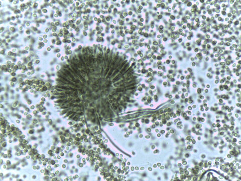 Micrograph of Anaphase, showing sister chromatids pulled to opposite poles in a plant cell