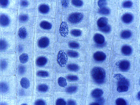 Micrograph of Anaphase, showing sister chromatids pulled to opposite poles in a plant cell