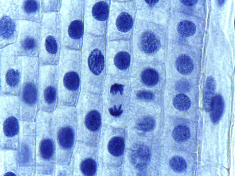 Micrograph of Anaphase, showing sister chromatids pulled to opposite poles in a plant cell