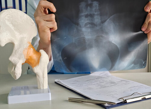Doctor evaluates hip x-ray with anatomical model in medical consultation concept - Powered by Adobe