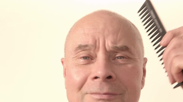 Mature bald man facing hair loss, no comb needed, considering trichology solutions, male baldness and growing need professional hair restoration, Hairless head, seeking medical help regrowth therapy