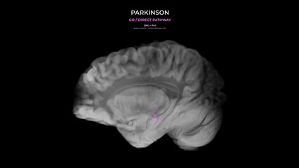 Parkinson Dopamine Loss Direct Pathway Disruption Sagittal View