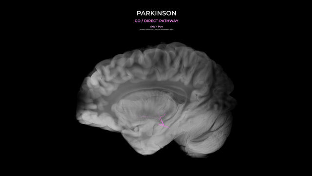 Parkinson Dopamine Loss Direct Pathway Disruption Sagittal View
