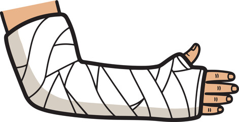 Broken Arm in Cast Graphic. Medical injury, recovery, and healthcare illustration for clinic or hospital