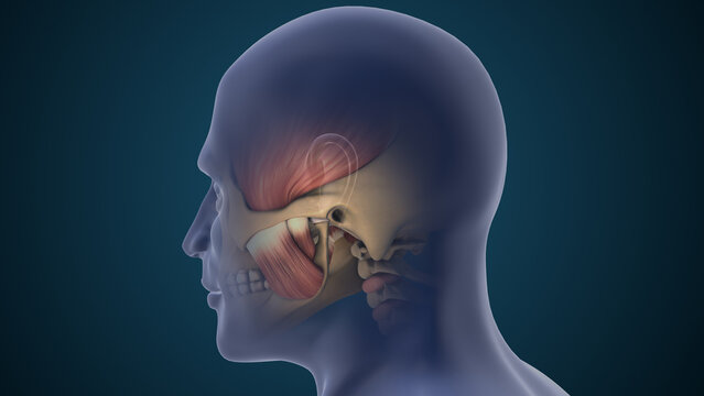 TMJ Disorder Causing Jaw Pain and Inflammation