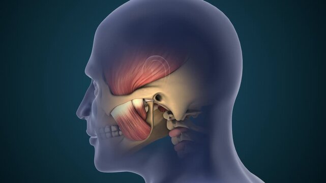 TMJ Disorder Causing Jaw Pain and Inflammation