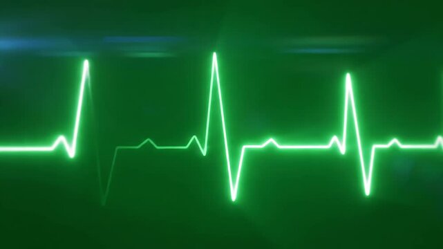 Green Screen 3d render of a heartbeat frequency on cardiograph recording pulse scene 3 with distortion, overlay, glitch, static noise, scan lines black background, 4k animated video loop