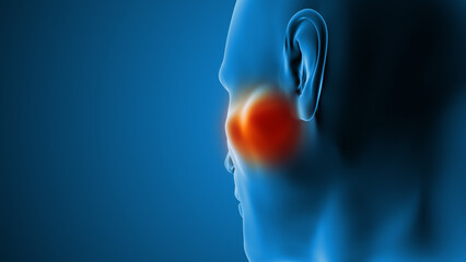 Human Parotid Gland Neoplastic Growth