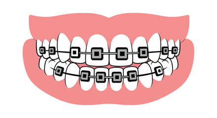 Teeth with braces orthodontic treatment dental care illustration editable