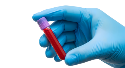 A gloved hand holding a test tube filled with blood, isolated on transparent background, for medical analysis