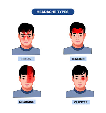 Tension, Cluster, and Migraine Headache Types Vector Illustration