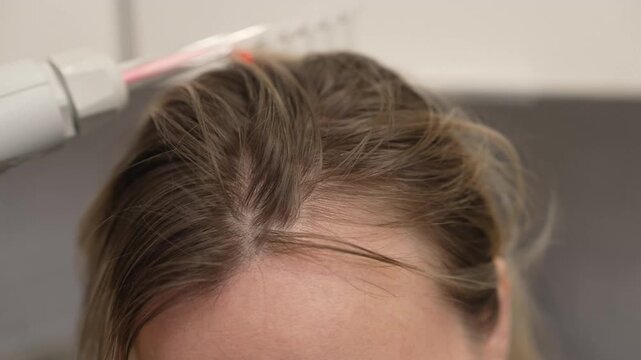 Trichologist using a darsonval comb for hair stimulation