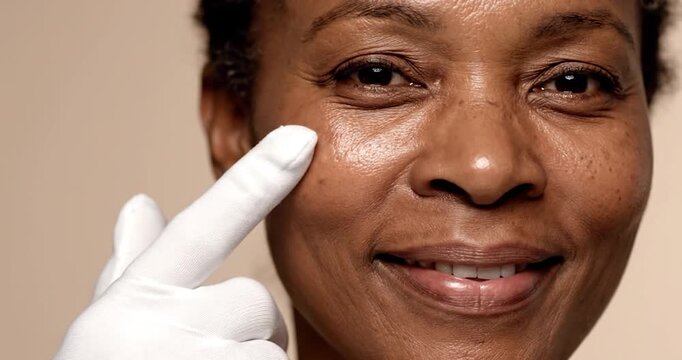 Laser Pigmentation Treatment for Dark Spots and Even Tone. Dermatology, beauty concept.