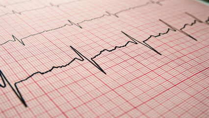 A close up of an electrocardiogram graph with black lines on a red grid pattern in a diagonal view