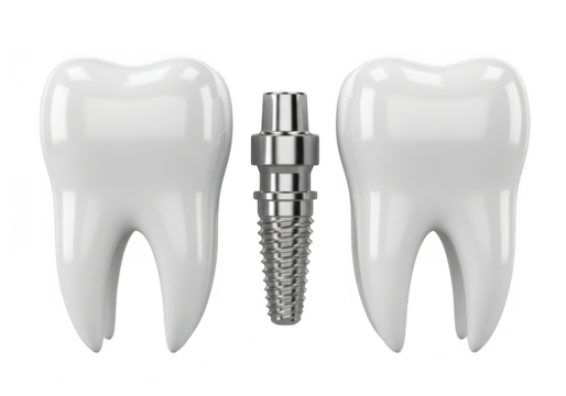Dental implant and two teeth isolated on transparent background