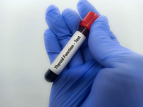 Doctor  holding a test blood sample for Thyroid Function  test. Laboratory medical testing concept.