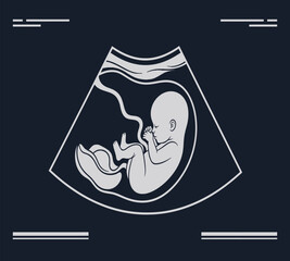 Illustration of ultrasound of a human fetus inside the mothers womb, showing the babys development and growth during pregnancy