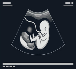 Illustration of ultrasound of a human fetus inside the mothers womb, showing the babys development and growth during pregnancy