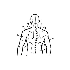 Acupuncture Treatment Needles in Back for Pain Relief.