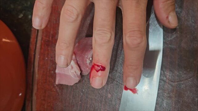 Knife safety tips while preparing food in kitchen with focus on hand injuries and proper techniques