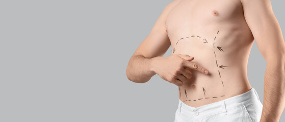 Young man with markings on his abdomen against grey background, closeup. Plastic surgery concept