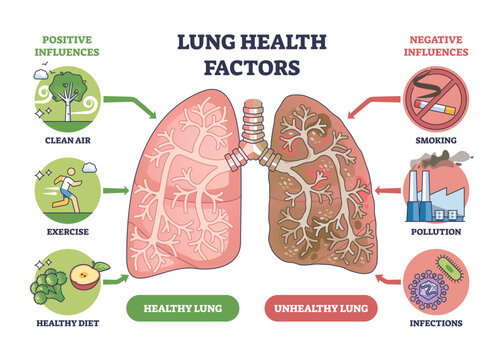 Lung health factors compare healthy vs unhealthy lungs, driven by smoking, pollution, and clean air, key objects, lungs, cigarette, factory. Outline diagram