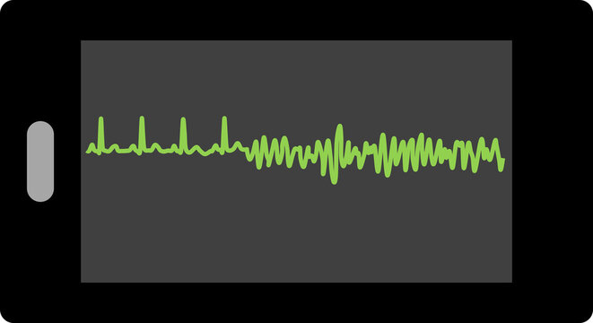心電図のグラフィック素材イラスト