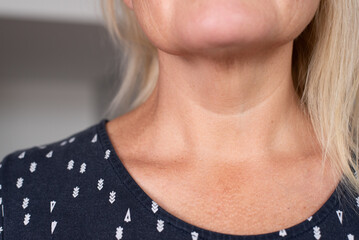 Close up of mature woman neck showing natural skin texture and early signs of aging. Concept of skincare, health, wellness, dermatology, beauty, and anti-aging treatment.