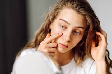 Fototapeta premium Close-up of young woman carefully examining skin in small mirror. Beautiful woman with acne touches face in cozy room. Concept of naturalness and beauty, dermatology. Acne.