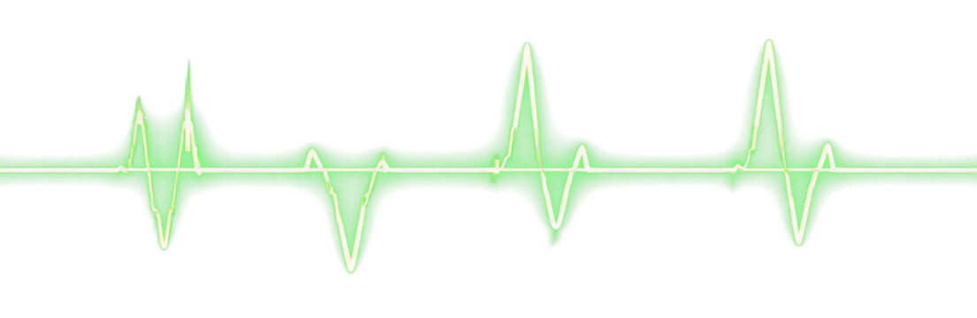 Green neon electrocardiogram line - medical clipart for overlay - Powered by Adobe