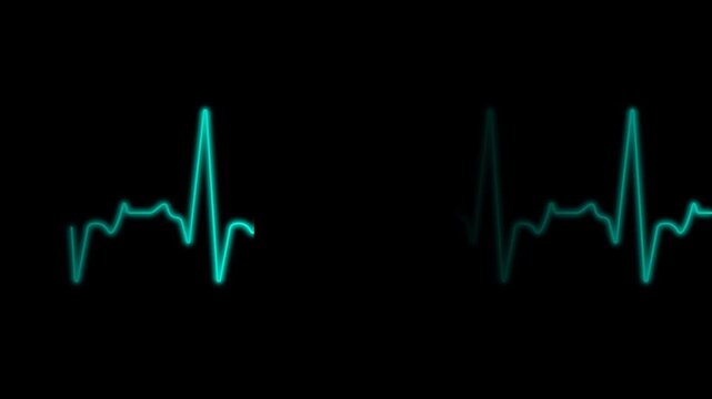Cardiogram cardiograph oscilloscope screen blue,  Ekg Or Ecg Looping background. Medical monitor displaying cardiograph pulse checkup. 4k video