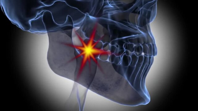 Animated Jaw Pain Transparent Skull with Temporomandibular Joint Disorder Highlighted in Red