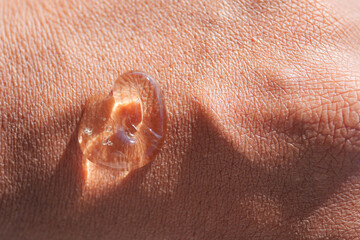 aloe vera gel resting on human skin during a sunny day