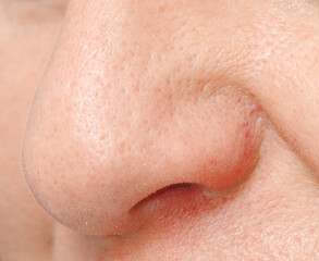 Obraz premium The nose is on a person's face. Close-up