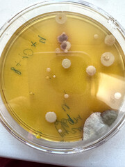 Multicolored colonies of microorganisms on a Petri dish.