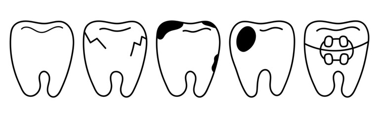 Doodle icon set with tooth states, healthy, cracked, decayed, filled, braces. Ideal for dental clinic brochures, health education materials, medical presentations, patient information leaflets