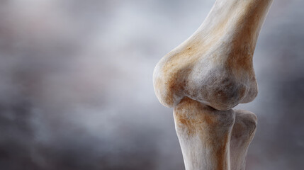 Bone joint anatomy osteoarthritis degeneration cartilage wear knee