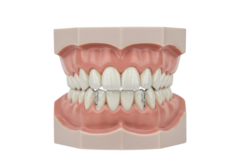 Isolated Dental Model with Crowns Illustrates Prosthodontics and Dentistry Education